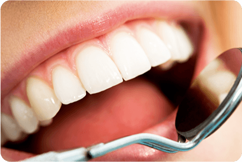 口腔内の治療(むし歯・歯周病など)